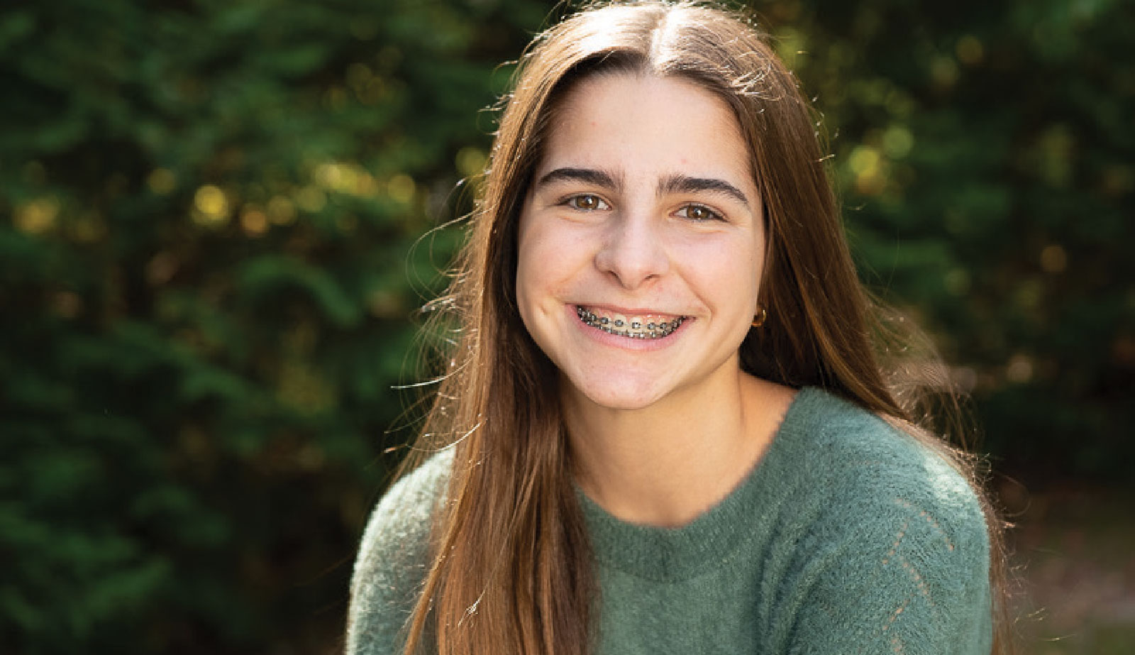 Teenage girl smiling wearing Damon Ultima Braces