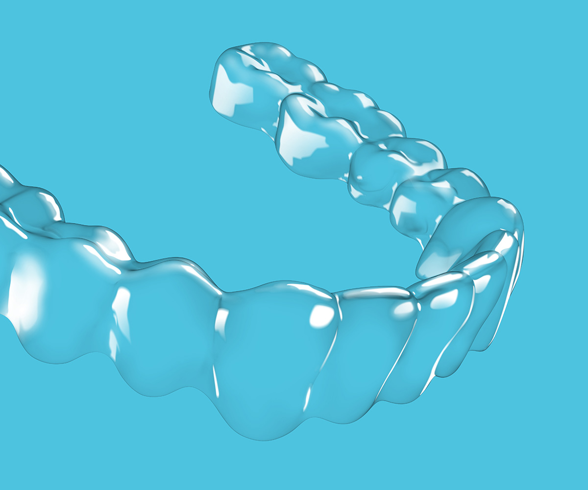 Spark Clear Aligner