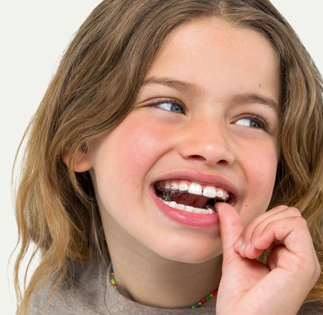 Young girl putting Spark Junior Clear Aligner in her mouth